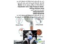 hl-mshakl-almaaa-aldaayf-shower-head-tnthyf-almyah-mn-alklor-oalshoayb-ras-dsh-altormalyn-zyad-dght-almaaa-otsfyh-almaaa-mn-alaosakh-small-2